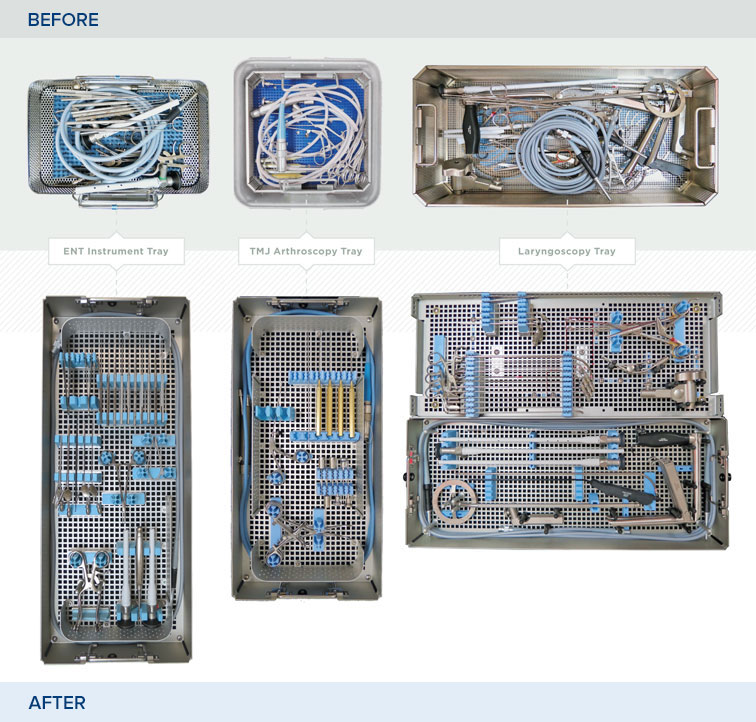 InstruSafe Custom Tray Comparison